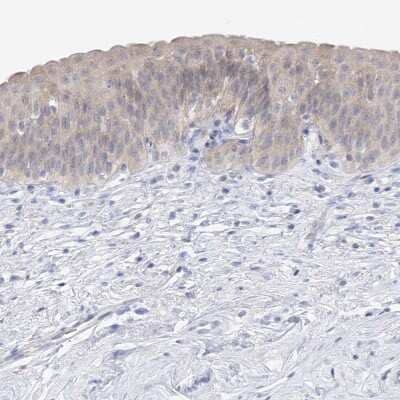 Immunohistochemistry-Paraffin: UFL1 Antibody [NBP1-90693] - Staining of human urinary bladder shows cytoplasmic positivity in urothelial cells.