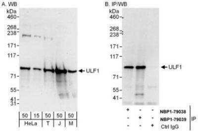 Western Blot: UFL1 Antibody [NBP1-79039] - Whole cell lysate from HeLa (15 and 50 mcg for WB; 1 mg for IP, 20% of IP loaded), 293T (T; 50 mcg), Jurkat (J; 50 mcg) and mouse NIH3T3 (M; 50 mcg) cells.  Antibodies: Affinity purified rabbit anti-ULF1 antibody used for WB at 0.04 mcg/ml (A) and 0.4 mcg/ml (B) and used for IP at 6 mcg/mg lysate.  ULF1 was also immunoprecipitated by rabbit anti-ULF1 antibody NBP1-79038 which recognizes an upstream epitope.