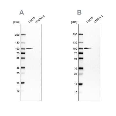 <b>Independent Antibodies Validation. </b>Western Blot: UFL1 Antibody [NBP1-90691] - Analysis using Anti-UFL1 antibody NBP1-90691 (A) shows similar pattern to independent antibody NBP1-90692 (B).