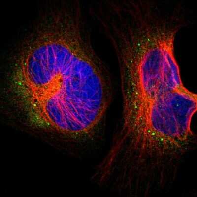 Immunocytochemistry/Immunofluorescence: UFM1 Activating Enzyme/UBA5 Antibody [NBP1-82087] - Immunofluorescent staining of human cell line U-2 OS shows localization to cytosol & vesicles.