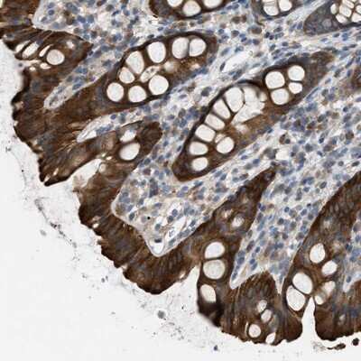 Immunohistochemistry-Paraffin: UFM1 Activating Enzyme/UBA5 Antibody [NBP1-82087] - Staining of human rectum shows strong cytoplasmic positivity in glandular cells.