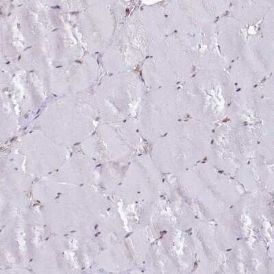 Immunohistochemistry-Paraffin: UFM1 Antibody [NBP1-88977] - Staining of human skeletal muscle shows no positivity in myocytes.