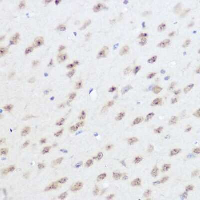 Immunohistochemistry-Paraffin UFM1 Antibody - Azide and BSA Free