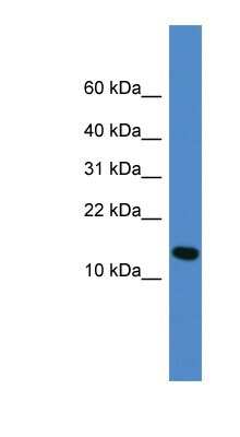 Western Blot: UFM1 Antibody [NBP1-79760] - Human Lung lysate, concentration 0.2-1 ug/ml.