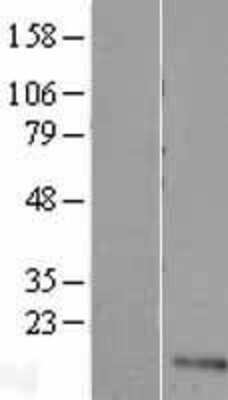 Western Blot UFSP1 Overexpression Lysate