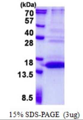 SDS-PAGE Recombinant Human UFSP1 His Protein