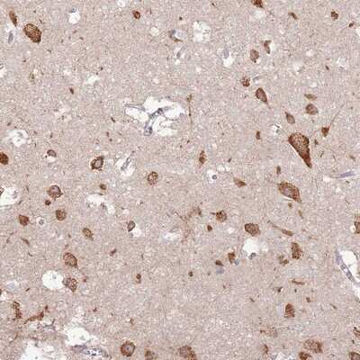 Immunohistochemistry-Paraffin: UGCGL2 Antibody [NBP2-13503] Staining of human cerebral cortex shows strong cytoplasmic positivity in neuronal cells.