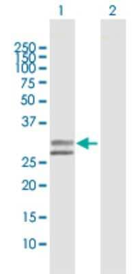 Western Blot: UGCGL2 Antibody [H00055757-D01P] - Analysis of UGCGL2 expression in transfected 293T cell line by UGCGL2 polyclonal antibody.Lane 1: UGCGL2 transfected lysate(31.40 KDa).Lane 2: Non-transfected lysate.