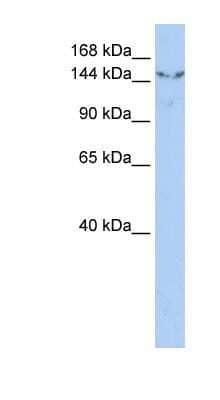 Western Blot: UGCGL2 Antibody [NBP1-79299] - HepG2 cell lysate, concentration 0.2-1 ug/ml.