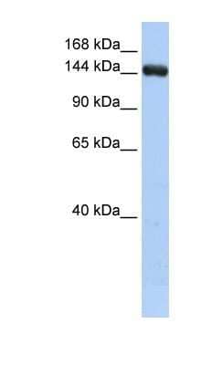 Western Blot: UGCGL2 Antibody [NBP1-79300] - HepG2 cell lysate, concentration 0.2-1 ug/ml.