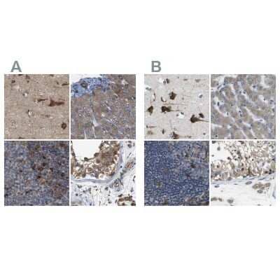 <b>Independent Antibodies Validation. </b>Immunohistochemistry-Paraffin: UGGT1 Antibody [NBP1-81652] - Staining of human cerebral cortex, liver, lymph node and testis using Anti-UGGT1 antibody NBP1-81652 (A) shows similar protein distribution across tissues to independent antibody NBP1-81651 (B).