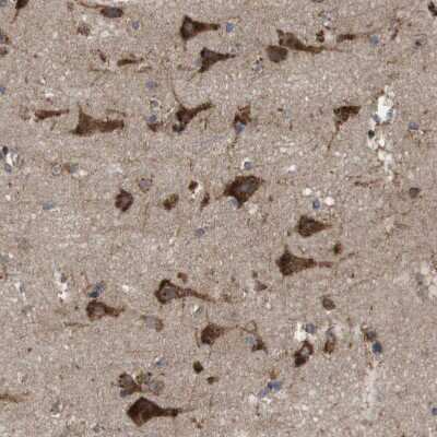 Immunohistochemistry-Paraffin: UGGT1 Antibody [NBP1-81652] - Staining of human Cerebral cortex shows strong granular cytoplasmic positivity in neuronal cells.