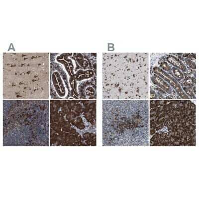 Immunohistochemistry-Paraffin: UGGT1 Antibody [NBP1-81652] - Staining of human cerebral cortex, gastrointestinal, lymphoid tissues and pancreas using Anti-UGGT1 antibody NBP1-81652 (A) shows similar protein distribution across tissues to independent antibody NBP1-81651 (B).