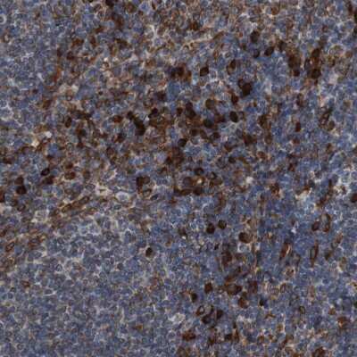 <b>Independent Antibodies Validation. </b>Immunohistochemistry-Paraffin: UGGT1 Antibody [NBP1-81652] - Staining of human Lymph node shows strong granular cytoplasmic positivity in non-germinal center cells.