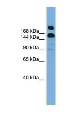 Western Blot: UGGT1 Antibody [NBP1-70764] - HepG2 cell lysate, concentration 0.2-1 ug/ml.