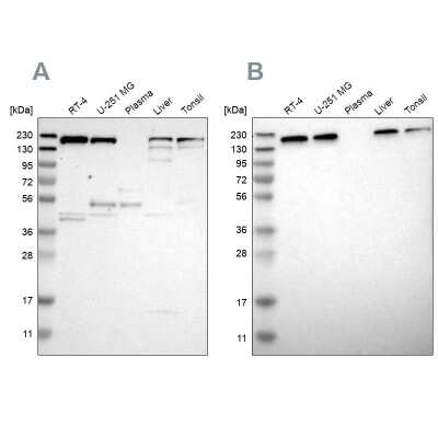 Western Blot UGGT1 Antibody - BSA Free