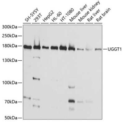 Western Blot: UGGT1 Antibody [NBP2-93283] - Analysis of extracts of various cell lines, using UGGT1 at 1:1000 dilution. Secondary antibody: HRP Goat Anti-Rabbit IgG (H+L) at 1:10000 dilution. Lysates/proteins: 25ug per lane. Blocking buffer: 3% nonfat dry milk in TBST. Detection: ECL Basic Kit . Exposure time: 10s.
