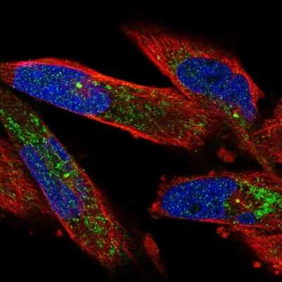 Immunocytochemistry/Immunofluorescence: UGP2 Antibody [NBP2-49427] - Staining of human cell line RH-30 shows localization to mitochondria & centrosome. Antibody staining is shown in green.