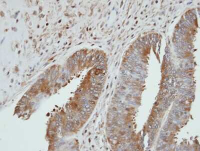 Immunohistochemistry-Paraffin: UGP2 Antibody [NBP1-32243] -  UGP2 xenograft, using UGP2 antibody at 1:100 dilution.  Antigen Retrieval: Trilogy™ (EDTA based, pH 8.0) buffer, 15min.