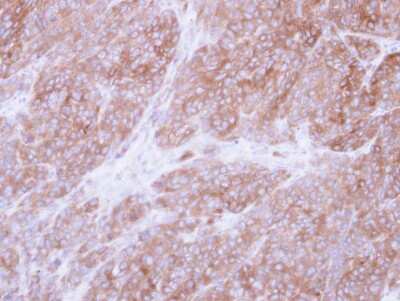 Immunohistochemistry-Paraffin: UGP2 Antibody [NBP1-32676] - Paraffin-embedded DLD-1 xenograft, using antibody at 1:500 dilution.