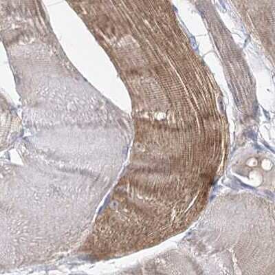 Immunohistochemistry-Paraffin: UGP2 Antibody [NBP1-85918] - Staining of human skeletal muscle.