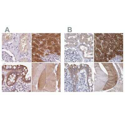 <b>Independent Antibodies Validation. </b>Immunohistochemistry-Paraffin: UGP2 Antibody [NBP2-49427] - Staining of human kidney, liver, rectum and skeletal muscle using Anti-UGP2 antibody NBP2-49427 (A) shows similar protein distribution across tissues to independent antibody NBP1-85918 (B).