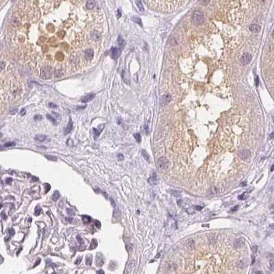 Immunohistochemistry-Paraffin: UGP2 Antibody [NBP2-49427] - Staining of human kidney.