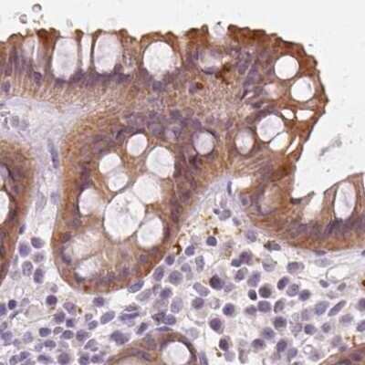 Immunohistochemistry-Paraffin: UGP2 Antibody [NBP2-49427] - Staining of human rectum.