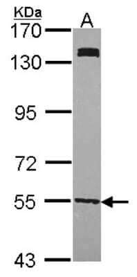 Western Blot: UGP2 Antibody [NBP1-32243] - Sample (30 ug of whole cell lysate) A: H1299 7. 5% SDS PAGE UGP2 antibody, antibody diluted at 1:1000.