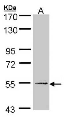 Western Blot: UGP2 Antibody [NBP1-32676] - Sample (30 ug of whole cell lysate)A: Hela S37C 5% SDS PAGE, antibody diluted at 1:1000.