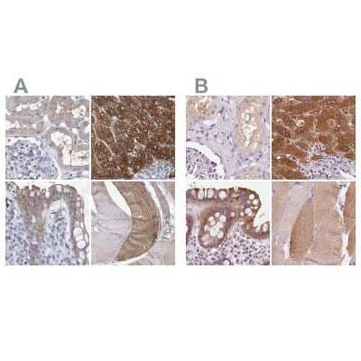 Immunohistochemistry-Paraffin: UGP2 Antibody [NBP1-85918] - Staining of human kidney, liver, rectum and skeletal muscle using Anti-UGP2 antibody NBP1-85918 (A) shows similar protein distribution across tissues to independent antibody NBP2-49427 (B).