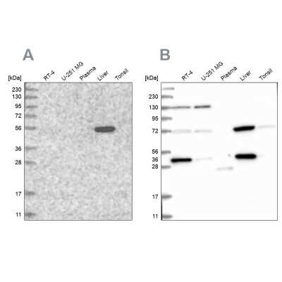 <b>Independent Antibodies Validation. </b>Western Blot: UGP2 Antibody [NBP1-85918] - Analysis using Anti-UGP2 antibody NBP1-85918 (A) shows similar pattern to independent antibody NBP2-48625 (B).