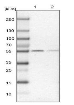 <b>Independent Antibodies Validation. </b>Western Blot: UGP2 Antibody [NBP1-85918] - Lane 1: Mouse liver tissue lyate Lane 2: Rat liver tissue lysate