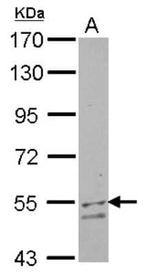 Western Blot: UGP2 Antibody [NBP2-20804] - Sample (30 ug of whole cell lysate) A: HepG2 7. 5% SDS PAGE gel, diluted at 1:500.