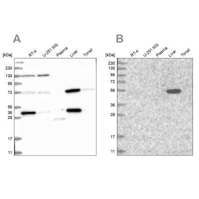 Western Blot: UGP2 Antibody [NBP2-48625] - Analysis using Anti-UGP2 antibody NBP2-48625 (A) shows similar pattern to independent antibody NBP1-85918 (B).