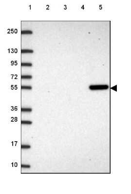 Western Blot: UGP2 Antibody [NBP2-49427] - Lane 1: Marker [kDa] 250, 130, 95, 72, 55, 36, 28, 17, 10Lane 2: Human cell line RT-4Lane 3: Human cell line U-251 MGLane 4: Human plasmaLane 5: Human Liver tissue