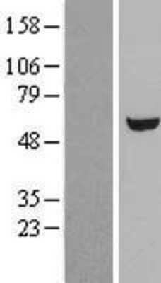 Western Blot: UGP2 Overexpression Lysate (Adult Normal) [NBL1-17595] Left-Empty vector transfected control cell lysate (HEK293 cell lysate); Right -Over-expression Lysate for UGP2.