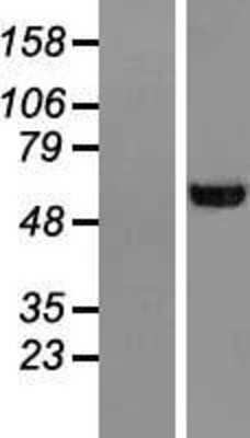 Western Blot: UGP2 Overexpression Lysate (Adult Normal) [NBL1-17596] Left-Empty vector transfected control cell lysate (HEK293 cell lysate); Right -Over-expression Lysate for UGP2.