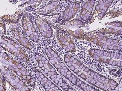 Immunohistochemistry-Paraffin: UGT Antibody [NBP2-98137] - Immunochemical staining of human UGT in human rectum with rabbit polyclonal antibody at 1:500 dilution, formalin-fixed paraffin embedded sections.