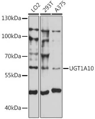 Western Blot: UGT1A10 Antibody [NBP2-94621] - Analysis of extracts of various cell lines, using UGT1A10 at 1:1000 dilution. Secondary antibody: HRP Goat Anti-Rabbit IgG (H+L) at 1:10000 dilution. Lysates/proteins: 25ug per lane. Blocking buffer: 3% nonfat dry milk in TBST. Detection: ECL Basic Kit . Exposure time: 10s.