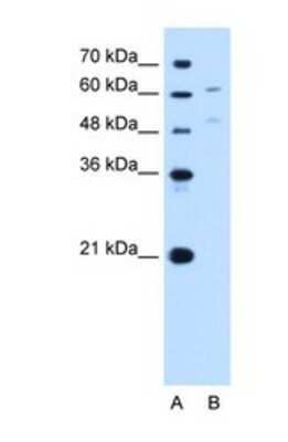 Western Blot: UGT1A4 Antibody [NBP1-69412] - This Anti-UGT1A4 antibody was used in Western Blot of HepG2 tissue lysate at a concentration of 1ug/ml.