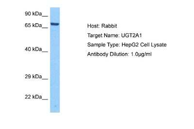 Western Blot: UGT2A1 Antibody [NBP2-83738] - Host: Rabbit. Target Name: UGT2A1. Sample Tissue: Human HepG2 Whole Cell lysates. Antibody Dilution: 1ug/ml