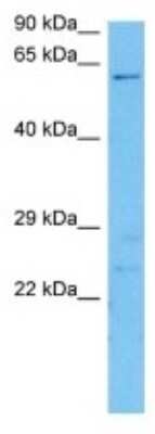Western Blot UGT2A2 Antibody - BSA Free