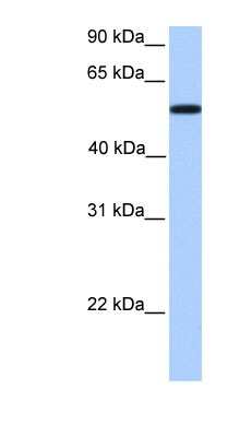 Western Blot: UGT2A3 Antibody [NBP1-62332] - NTERA2 cell lysate, concentration 0.2-1 ug/ml.