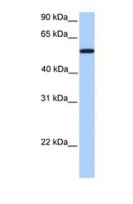 Western Blot: UGT2A3 Antibody [NBP1-69358] - This Anti-UGT2A3 antibody was used in Western Blot of NTERA2 tissue lysate at a concentration of 1ug/ml.