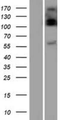 Western Blot: UGT2B10 Overexpression Lysate (Adult Normal) [NBP2-08443] Left-Empty vector transfected control cell lysate (HEK293 cell lysate); Right -Over-expression Lysate for UGT2B10.