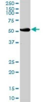 Western Blot UGT2B15 Antibody