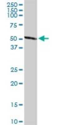 Western Blot UGT2B15 Antibody