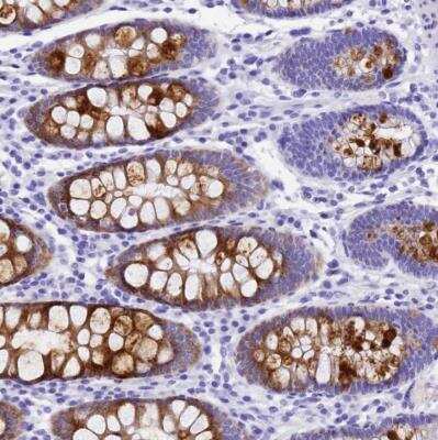 Immunohistochemistry-Paraffin: UGT2B4 Antibody [NBP2-54718] - Staining of human colon shows strong cytoplasmic positivity in goblet cells.