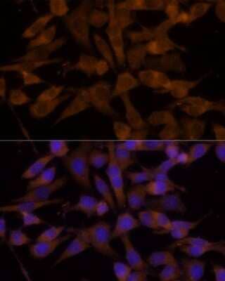 Immunocytochemistry/Immunofluorescence: UGT2B7 Antibody [NBP2-94823] - Analysis of HeLa cells using UGT2B7 . Blue: DAPI for nuclear staining.